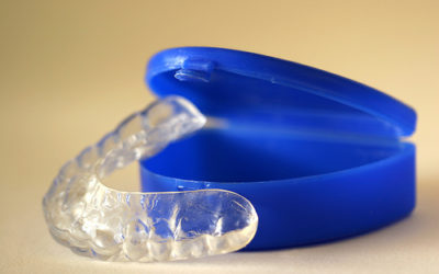 Mouthguard Q&A