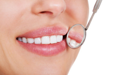 Which whitening is right for you?