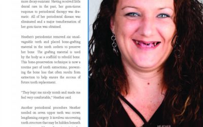 How A Smile Makeover Can Change Your Life