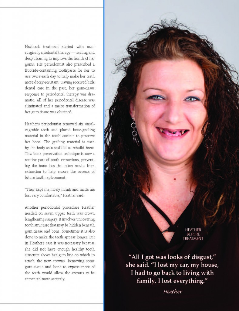 How A Smile Makeover Can Change Your Life