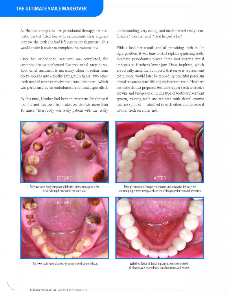 How A Smile Makeover Can Change Your Life