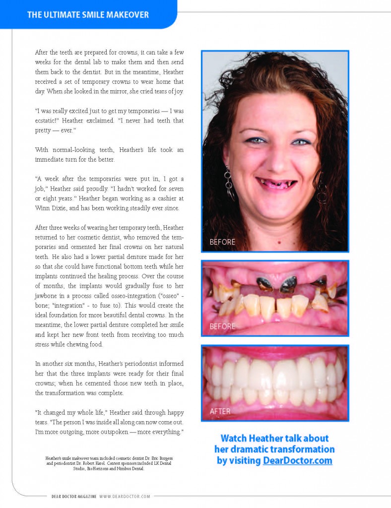 How A Smile Makeover Can Change Your Life