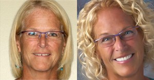 To Smile or Not to Smile…Is a Smile Makeover Right for You?
