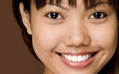 Teeth Whitening Omaha NE