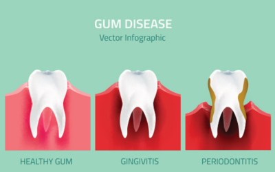 What is Gum Disease?